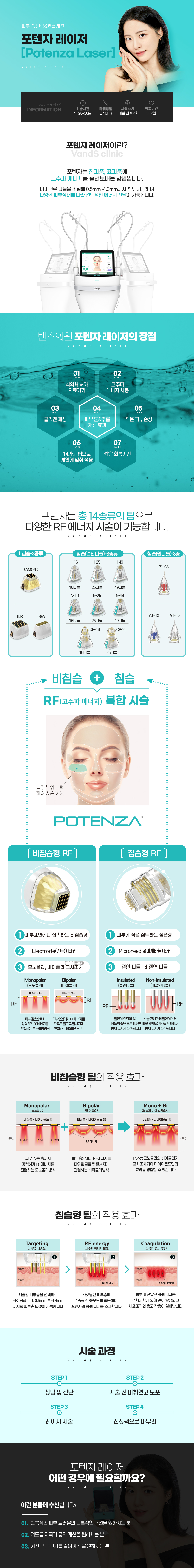 포텐자 시술안내 이미지1