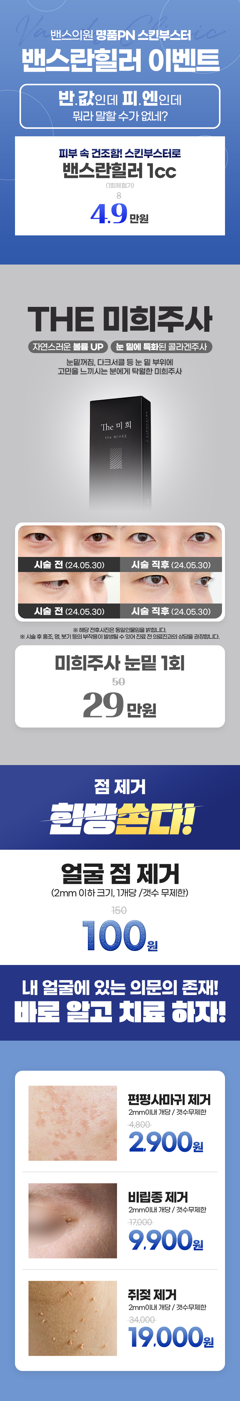 대치점 이벤트 이미지5